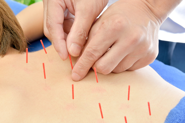 柔整・鍼灸を学ぶ